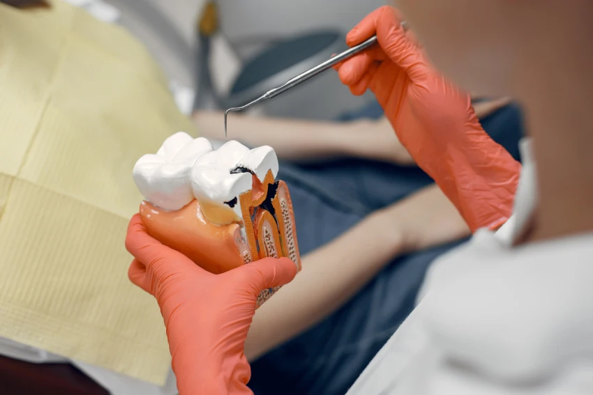 Tratamiento de endodoncia en Piura
