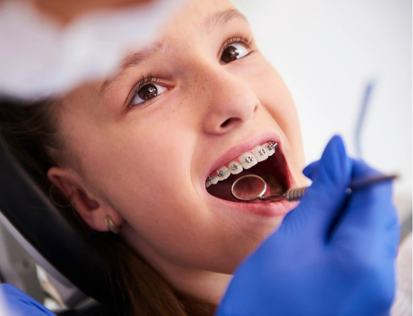 Ortodoncia en niños en Piura